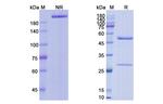 Vorsetuzumab Humanized Antibody in SDS-PAGE (SDS-PAGE)