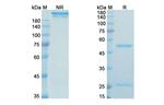 Modotuximab Chimeric Antibody in SDS-PAGE (SDS-PAGE)