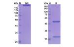 Concizumab Humanized Antibody in SDS-PAGE (SDS-PAGE)