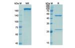 PCSK9 (Evolocumab Biosimilar) Antibody in SDS-PAGE (SDS-PAGE)