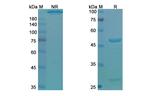Dupilumab Antibody in SDS-PAGE (SDS-PAGE)