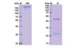 Tildrakizumab Humanized Recombinant Human Monoclonal Antibody