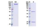 Dusigitumab Recombinant Human Monoclonal Antibody