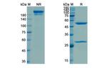 Nesvacumab Antibody in SDS-PAGE (SDS-PAGE)
