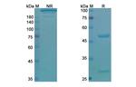 PD-1 (CD279) (Pidilizumab Biosimilar) Antibody in SDS-PAGE (SDS-PAGE)