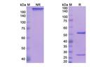 Nogo-A/B (Ozanezumab Biosimilar) Recombinant Humanized mouse Monoclonal Antibody
