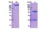 Seribantumab Recombinant Human Monoclonal Antibody