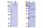 Bimagrumab Antibody in SDS-PAGE (SDS-PAGE)