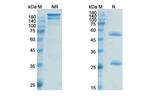 Pinatuzumab Humanized Recombinant Human Monoclonal Antibody