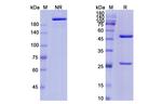 CD79b (Polatuzumab Biosimilar) Antibody in SDS-PAGE (SDS-PAGE)