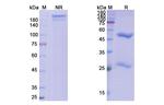 Shiga toxin 1 (Pritoxaximab Biosimilar) Antibody in SDS-PAGE (SDS-PAGE)