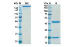 Lodelcizumab Humanized Antibody in SDS-PAGE (SDS-PAGE)