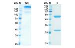 Eldelumab Antibody in SDS-PAGE (SDS-PAGE)