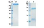 Dinutuximab Chimeric Antibody in SDS-PAGE (SDS-PAGE)