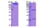 Alpha-hemolysin (Tosatoxumab Biosimilar) Antibody in SDS-PAGE (SDS-PAGE)