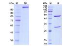 Glypican 3 (Codrituzumab Biosimilar) Antibody in SDS-PAGE (SDS-PAGE)