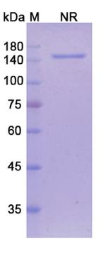 Tarextumab Antibody in SDS-PAGE (SDS-PAGE)