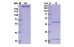 Guselkumab Recombinant Human Monoclonal Antibody