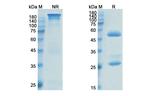 Anetumab Antibody in SDS-PAGE (SDS-PAGE)