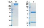 Her-2 (ErbB2) (Margetuximab Biosimilar) Antibody in SDS-PAGE (SDS-PAGE)