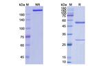 IFNAR1 (Anifrolumab Biosimilar) Recombinant Human Monoclonal Antibody