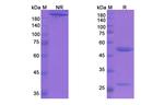 Aducanumab Recombinant Human Monoclonal Antibody