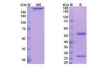 IL-20 (Fletikumab Biosimilar) Recombinant Human Monoclonal Antibody