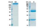 Ralpancizumab Humanized Recombinant Human Monoclonal Antibody
