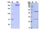 Bococizumab Humanized Recombinant Human Monoclonal Antibody