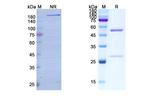 Bimekizumab Humanized Antibody in SDS-PAGE (SDS-PAGE)