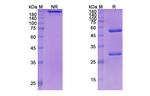 Coltuximab Chimeric Recombinant Human Monoclonal Antibody