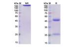 Ontuxizumab Chimeric Recombinant Human Monoclonal Antibody