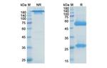 Brontictuzumab Humanized Antibody in SDS-PAGE (SDS-PAGE)
