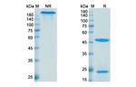 Denintuzumab Humanized Recombinant Human Monoclonal Antibody