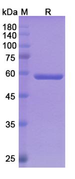PSMA/CD3 (Pasotuxizumab Biosimilar) Antibody in SDS-PAGE (SDS-PAGE)