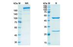 CSF1R (CD115) (Emactuzumab Biosimilar) Antibody in SDS-PAGE (SDS-PAGE)