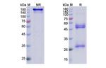 Lenzilumab Antibody in SDS-PAGE (SDS-PAGE)