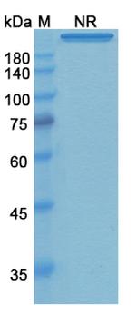 Remtolumab Antibody in SDS-PAGE (SDS-PAGE)