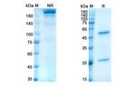 Lacutamab Chimeric Recombinant Human Monoclonal Antibody