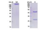 Atezolizumab Humanized Antibody in SDS-PAGE (SDS-PAGE)