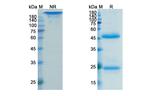 Lokivetmab Recombinant Canine Monoclonal Antibody