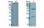Durvalumab Humanized Antibody in SDS-PAGE (SDS-PAGE)