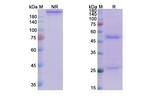 Andecaliximab Chimeric Antibody in SDS-PAGE (SDS-PAGE)