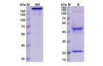 Her-3 (ErbB3) (Elgemtumab Biosimilar) Recombinant Human Monoclonal Antibody
