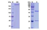 Tesidolumab Antibody in SDS-PAGE (SDS-PAGE)