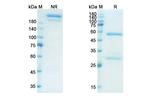 IL-13 (Dectrekumab Biosimilar) Recombinant Human Monoclonal Antibody