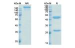 Isatuximab Chimeric Antibody in SDS-PAGE (SDS-PAGE)