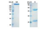 Indusatumab Recombinant Human Monoclonal Antibody