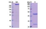 Bermekimab Humanized Antibody in SDS-PAGE (SDS-PAGE)