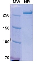 Istiratumab Recombinant Human Monoclonal Antibody